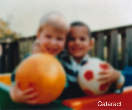 Kids holding balls as seen by person with cataracts
