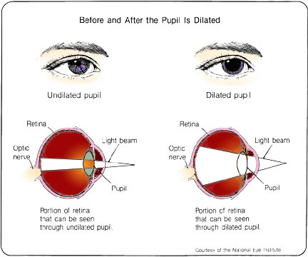 Diagram:  before and after pupil is  dilated